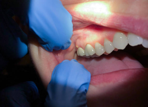 Best Emergency Dentist Open Today  in St John, MO